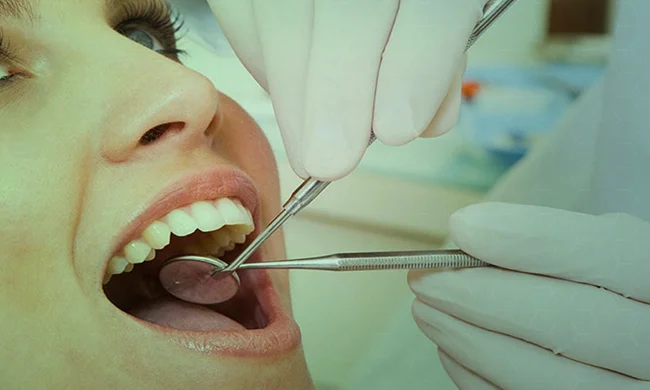 Restaurações dentárias